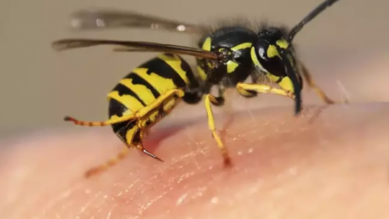 Arı sokması deyip geçmeyin; 20 yaşındaki kız...