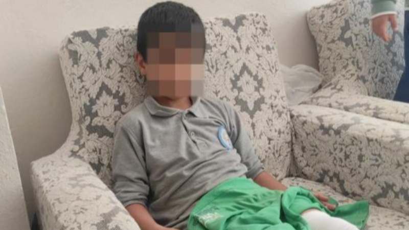 Bursa'da 8 yaşındaki çocuğa köpek saldırdı