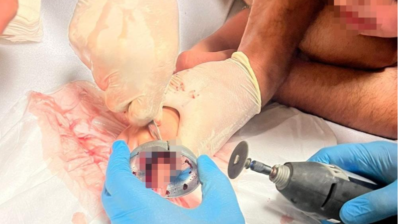 Bursa'da itfaiye ekipleri küçük çocuk için seferber oldu