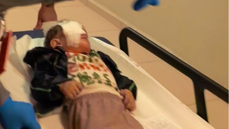 Bursa'da patlayan torpil 2 yaşındaki çocuğu  bu hale getirdi!