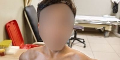 Bursa’da kene vakası; 7 yaşındaki çocuk...