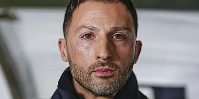 Domenico Tedesco, Gaziantep FK maçında yok
