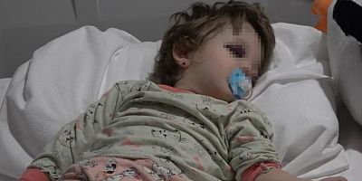 İnanılır gibi değil; 14 aylık bebeğe saldırdılar...